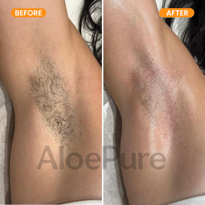 AloePure Smooth Hair Removal Cream