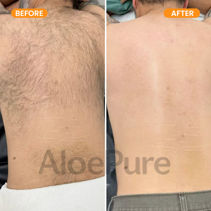AloePure Smooth Hair Removal Cream