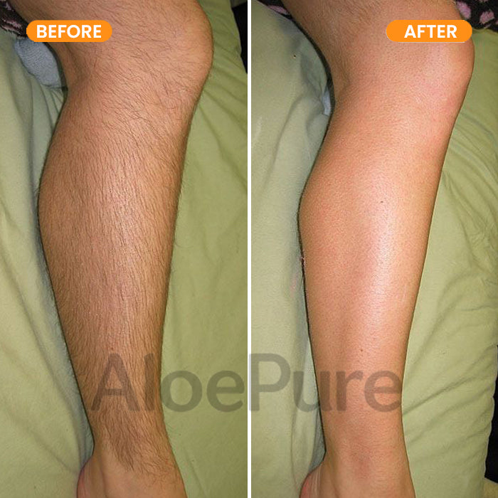 AloePure Smooth Hair Removal Cream