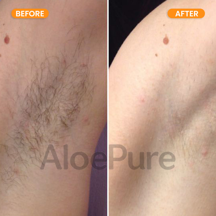 AloePure Smooth Hair Removal Cream